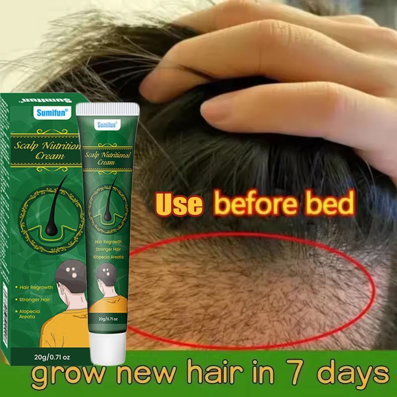 Hair Care Dupes - 빠른 생강 모발 성장 크림 탈모