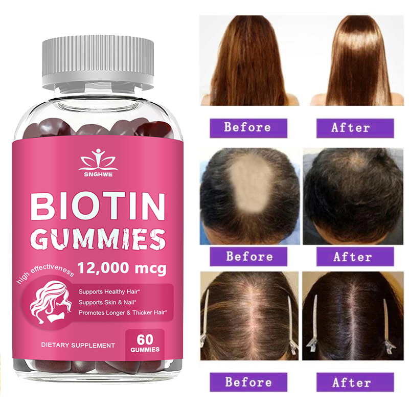 Hair Care Gummies - 콜라겐 구미 스킨 케어를 위한 비오틴