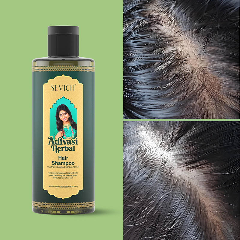 SEVICH 허벌 모발 성장 오일 세트 Ayurvedi - Hair Care India 리뷰 및 가격