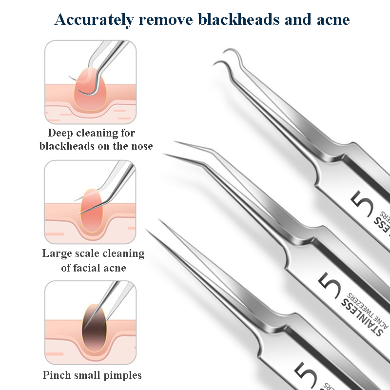 1Pcs 내장형 헤어 핀셋 여드름 블랙헤드 제거 바늘  - Hair Care Tools 리뷰 및 가격