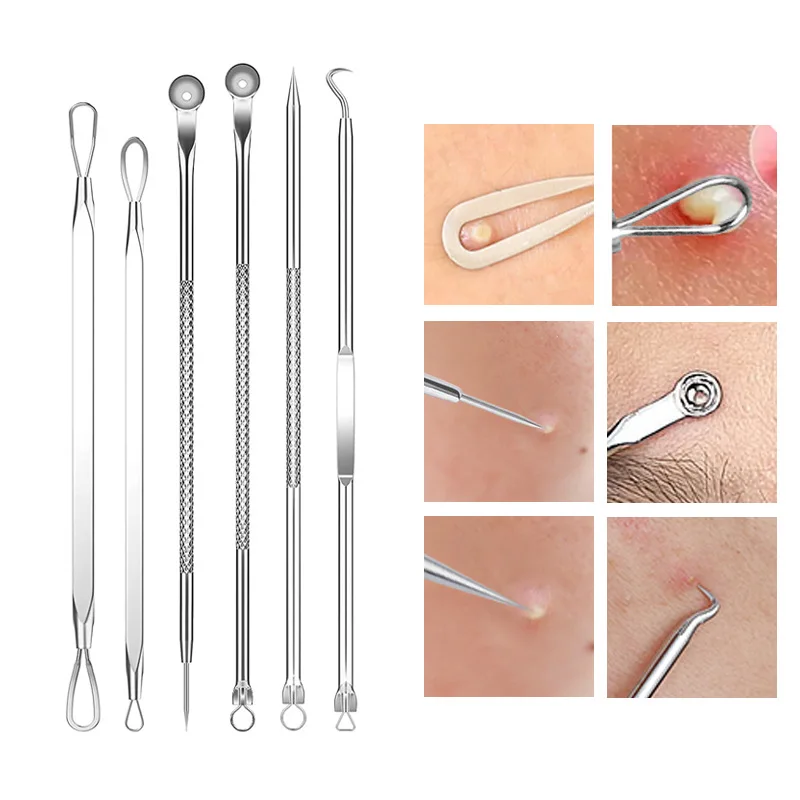 1Pcs 내장형 헤어 핀셋 여드름 블랙헤드 제거 바늘  - Hair Care Tools 리뷰 및 가격